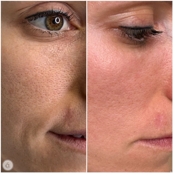 GlowLuxe Strahlende Haut Maske